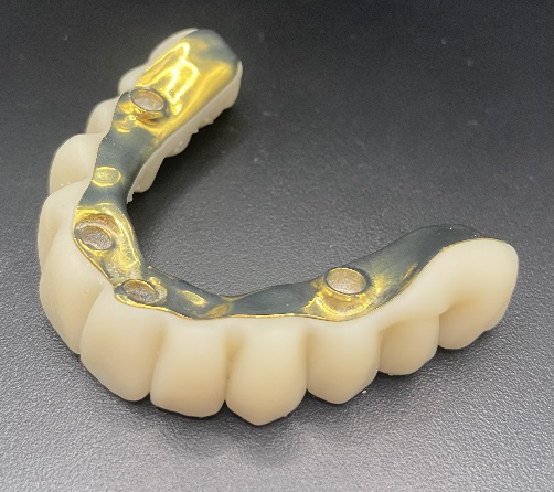 Implantología y cirugía guiada